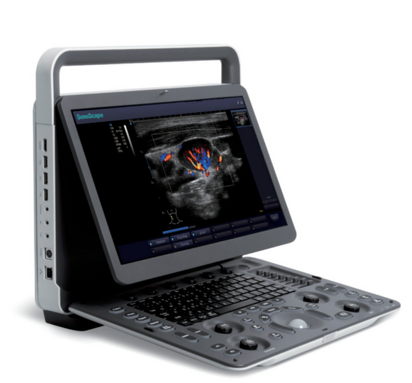 SonoScape E1ExpV Color Doppler