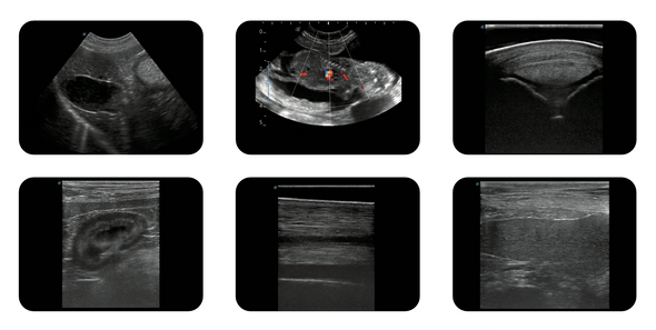 SonoScape E1ExpV Color Doppler