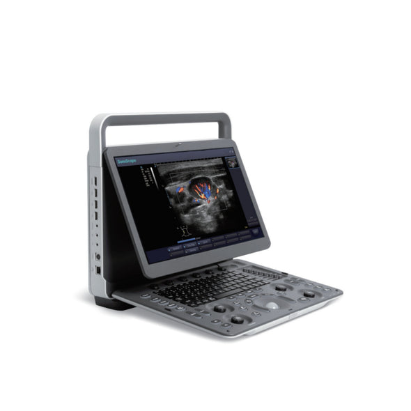 SonoScape E1ExpV Color Doppler