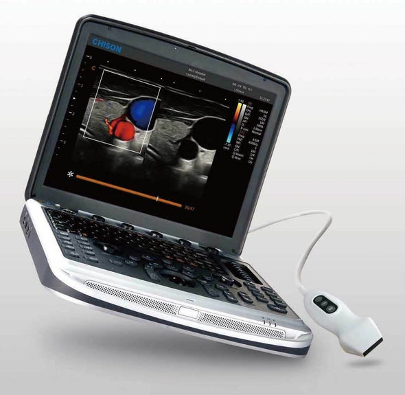 Chison Sonobook 9 Color Doppler Ultrasound with 3 probes