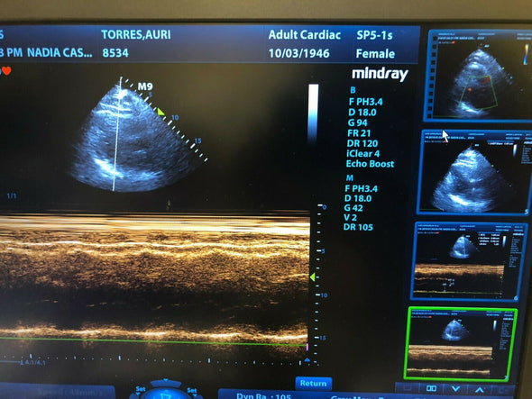 Mindray M9 Portable Ultrasound with 4 probes