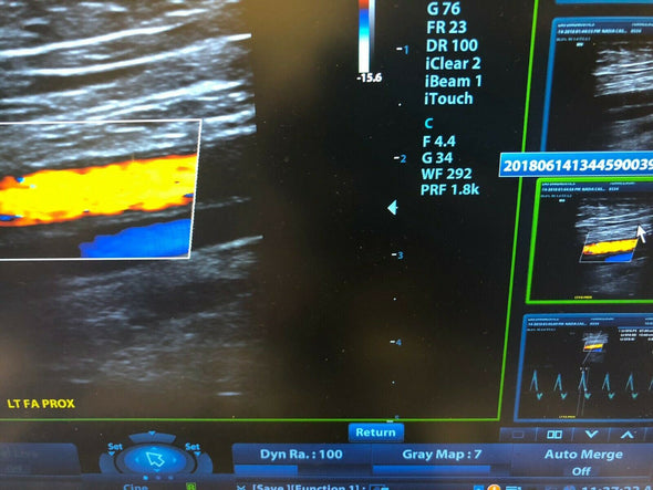 Mindray M9 Portable Ultrasound with 4 probes