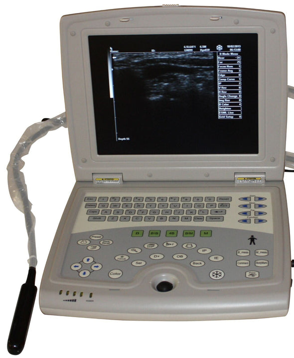 Veterinary Laptop Ultrasound Scanner 10" LCD & Rectal Probe - USA Warranty Deal