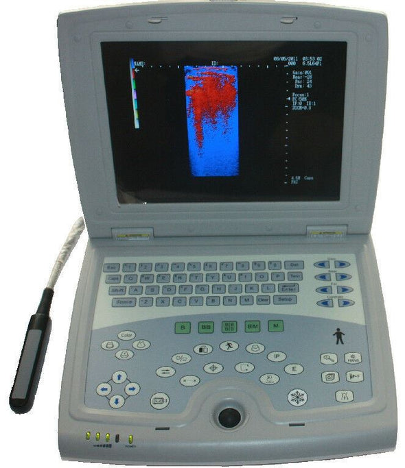 Veterinary Laptop Ultrasound Scanner 10" LCD & Rectal Probe - USA Warranty Deal