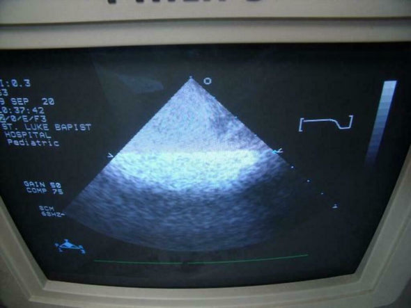 PHILIPS 21311A S3 ULTRASOUND PROBE | PR163