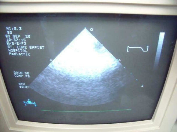 PHILIPS 21311A S3 ULTRASOUND PROBE | PR163