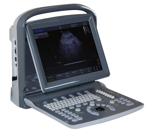 Chison ECO1 Portable LED Ultrasound Scanner two probes Convex &  linear array