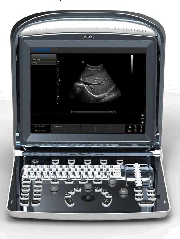 Chison ECO1 Portable LED Ultrasound Scanner two probes Convex &  linear array