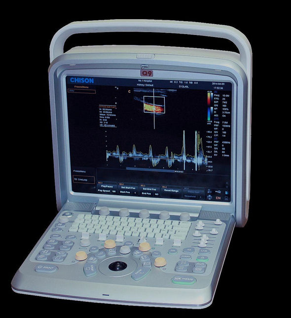 Chison Ebit 30 Color Doppler Ultrasound Scanner with Linear Array Probe 7-18MHz