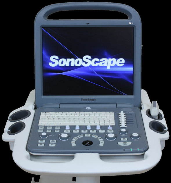 SonoScape S2 with Linear Array Probe for MSK, Vascular Ultrasound