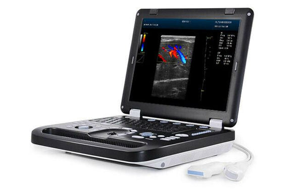 Newest- Color Portable Ultrasound & One Probe, DICOM, LED screen