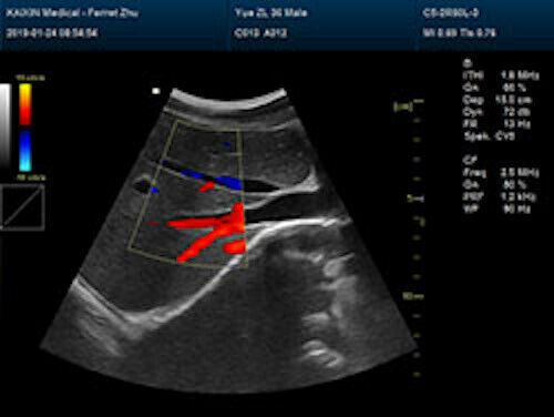 Newest- Color Portable Ultrasound & One Probe, DICOM, LED screen