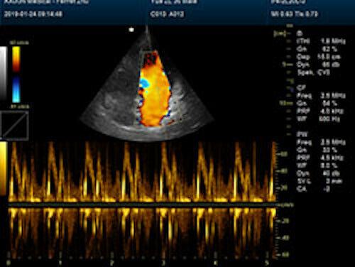 Newest- Color Portable Ultrasound & One Probe, DICOM, LED screen