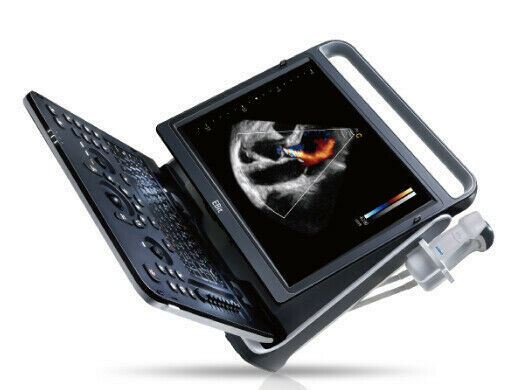 Chison eBit60Vet High End Color Doppler Veterinary Software Portable Ultrasound