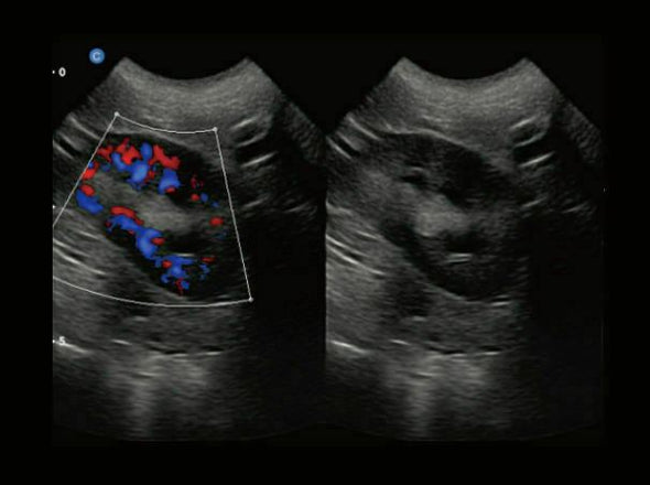 Chison eBit50Vet Color Doppler Ultrasound with Micro Convex Probe