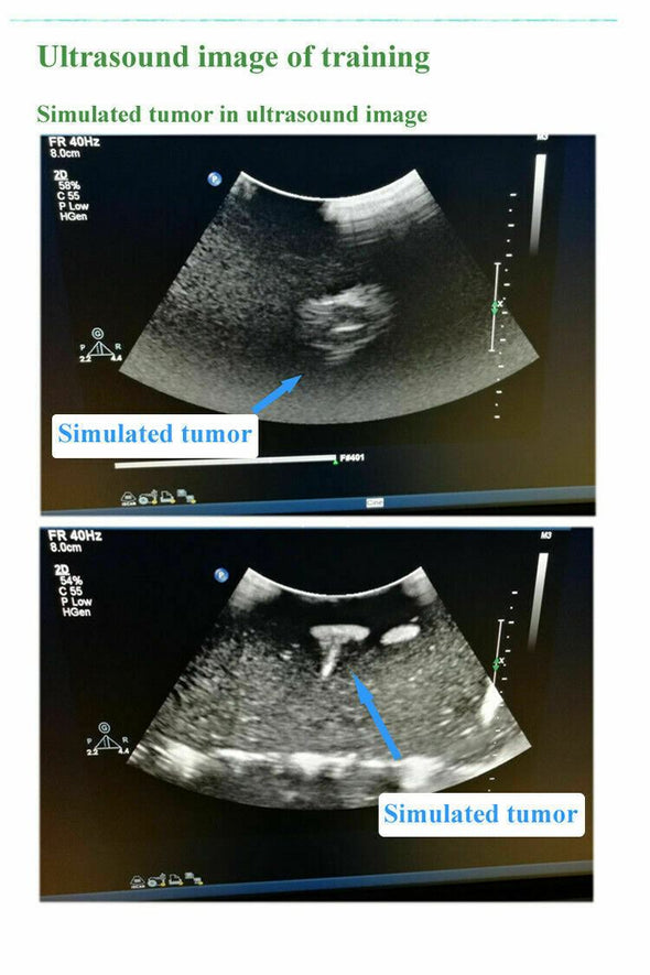 Model for Interventional Ultrasound, Soft tissue, B-Ultrasound Training Teaching