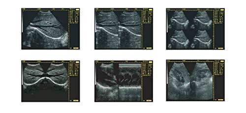 keebomed WED-3100V Veterinary Ultrasound for Large Animals