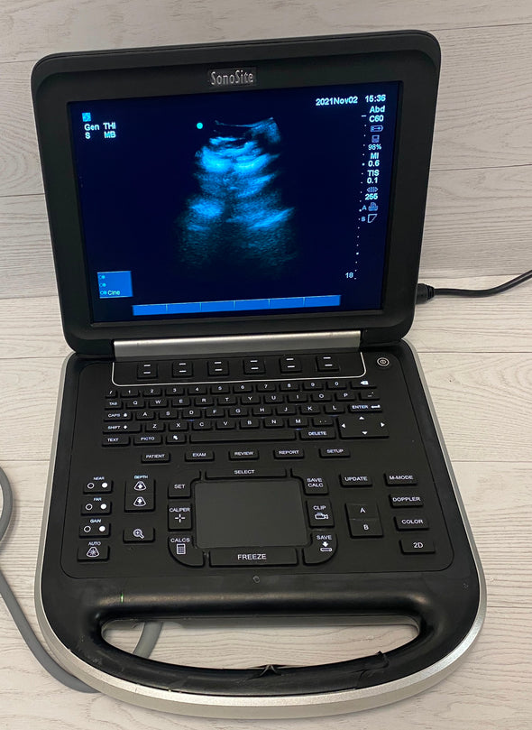 Sonosite Edge Portable ultrasound Manufactured 2012