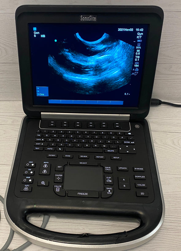 Sonosite Edge Portable ultrasound Manufactured 2012