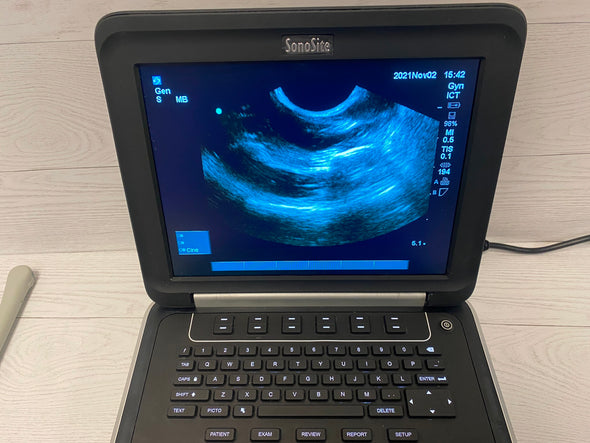 Sonosite Edge Portable ultrasound Manufactured 2012