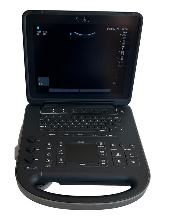 Sonosite Edge II Ultrasound 2017/Color, DICOM & 3 Probes L38xi & rC60Xi rP19x