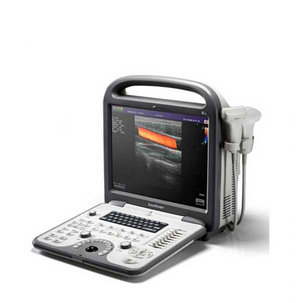 SonoScape S6V Ultrasound - Deals on Veterinary Ultrasounds
 - 1